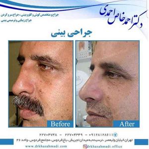 جراح بینی خوب در تهران